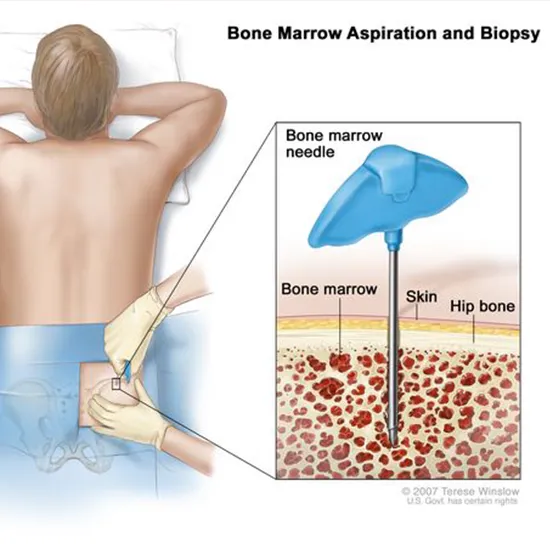 Bone Marrow Scan